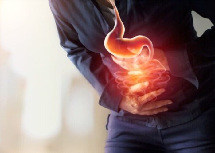 STOMACH AND BOWEL ayurved treatment