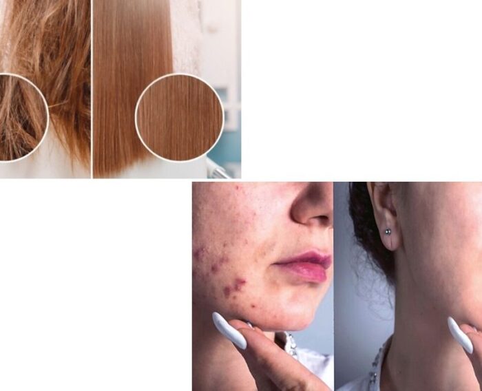 hair and skin care ayurved treatment