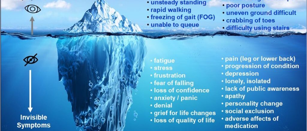 Primary Orthostatic Tremor (POT): An Integrative View through Neurology & Ayurveda