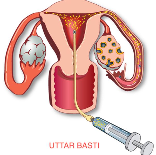 Uttar Basti